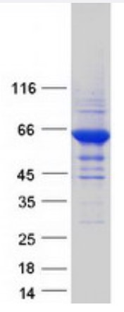 SDS-PAGE (RPE65-3583H).jpg